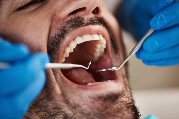 Best Pediatric Emergency Dentist in Medina, OH